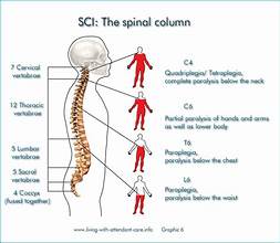 Spinal Cord Injury (SCI)
