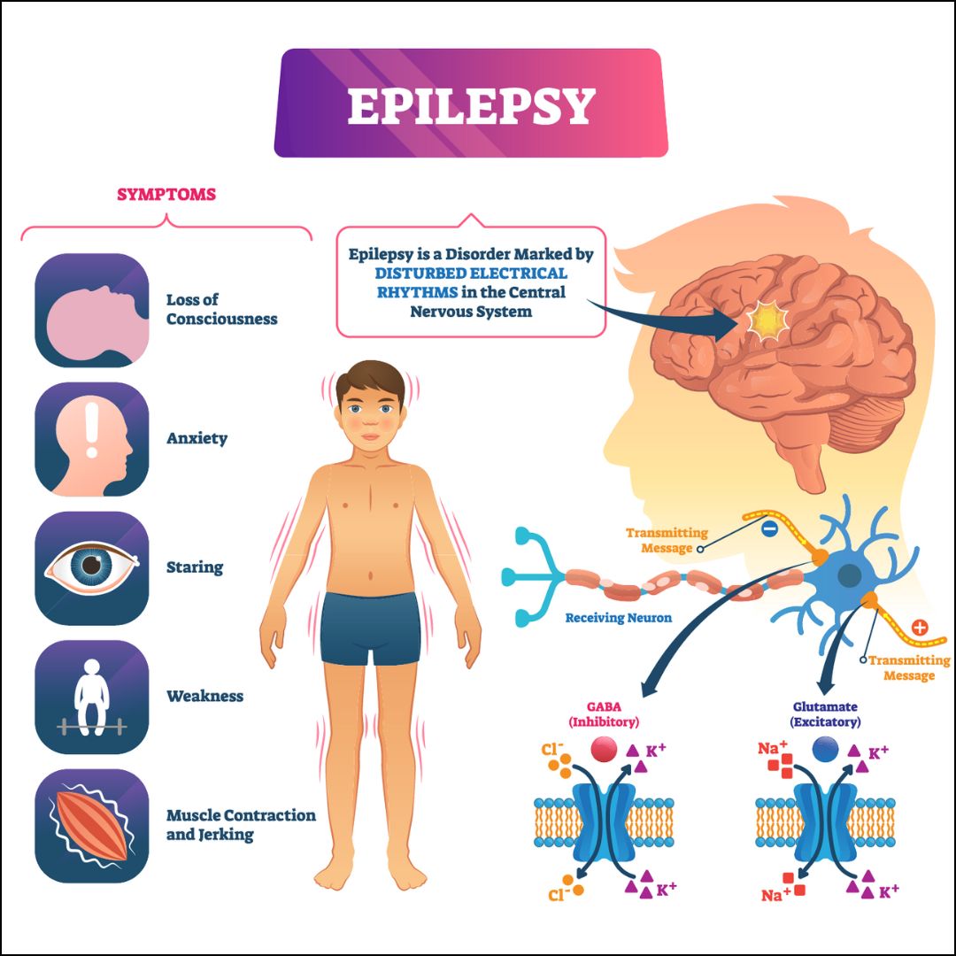 Epilepsy